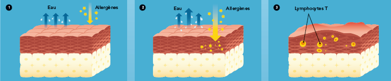 zoom sur la peau