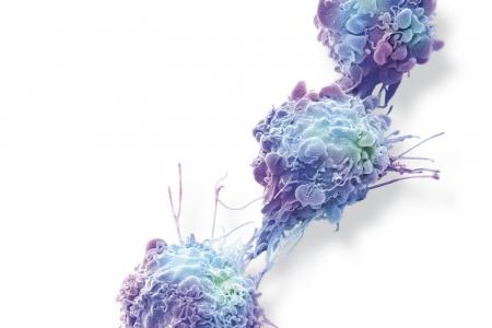 L’oncologie de précision : une nouvelle ère dans la lutte contre le cancer