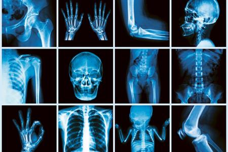 La fin du tablier en plomb en radiologie