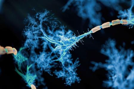 Espoir pour la sclérose en plaques