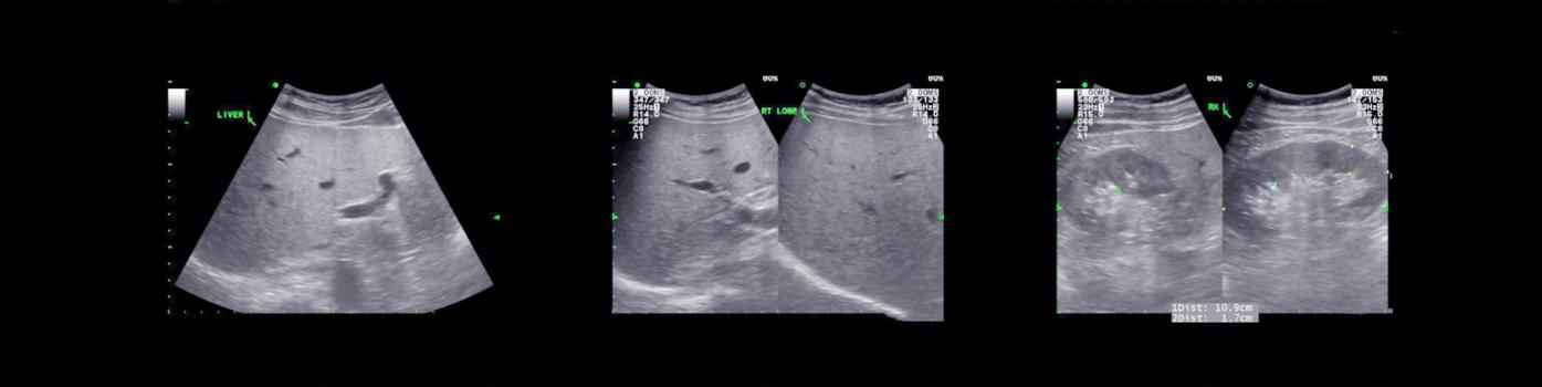 ultrasonographie ciblée 