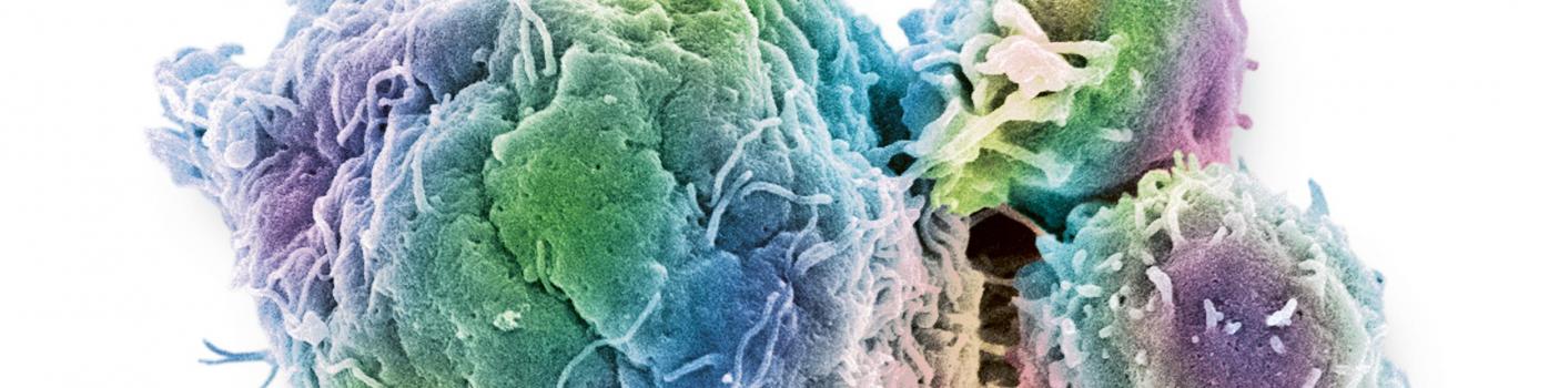 Cellule cancéreuse colorectale
