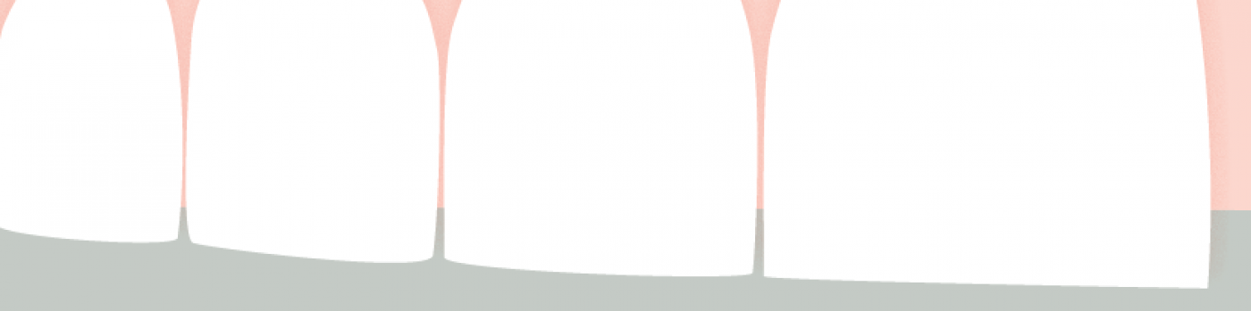 illustration dents