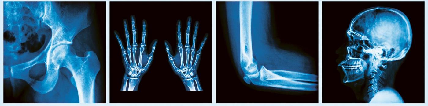 La fin du tablier en plomb en radiologie