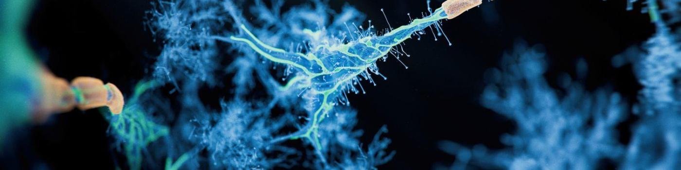 Espoir pour la sclérose en plaques