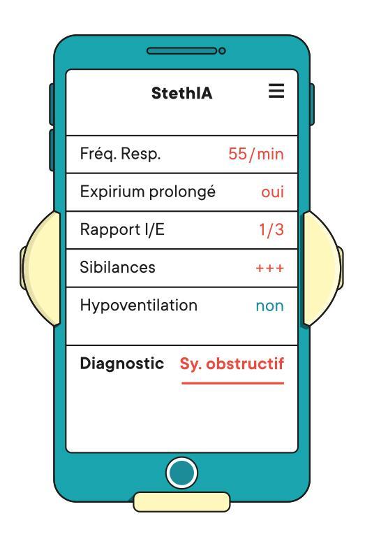 Une aide au diagnostic qui pourrait sauver des vies.