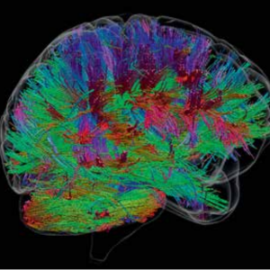 connexions neuronales