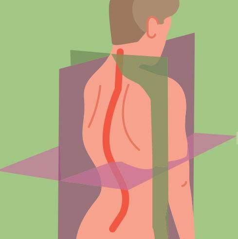 scoliose - déformation en 3D scoliose - déformation en 3D