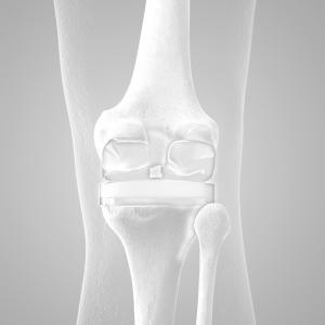 chirurgie orthopédique