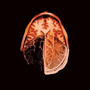 image montrant différents composants du cerveau