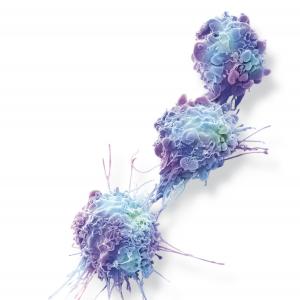 L’oncologie de précision : une nouvelle ère dans la lutte contre le cancer