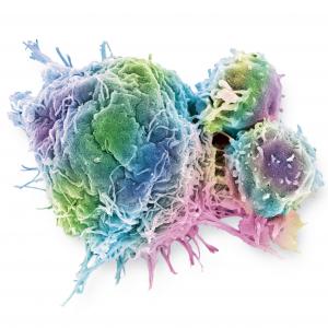 Cellule cancéreuse colorectale