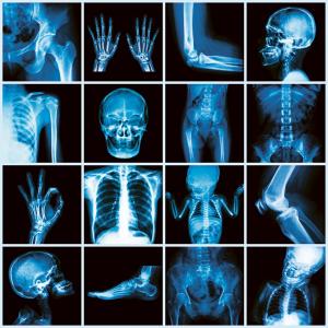 La fin du tablier en plomb en radiologie
