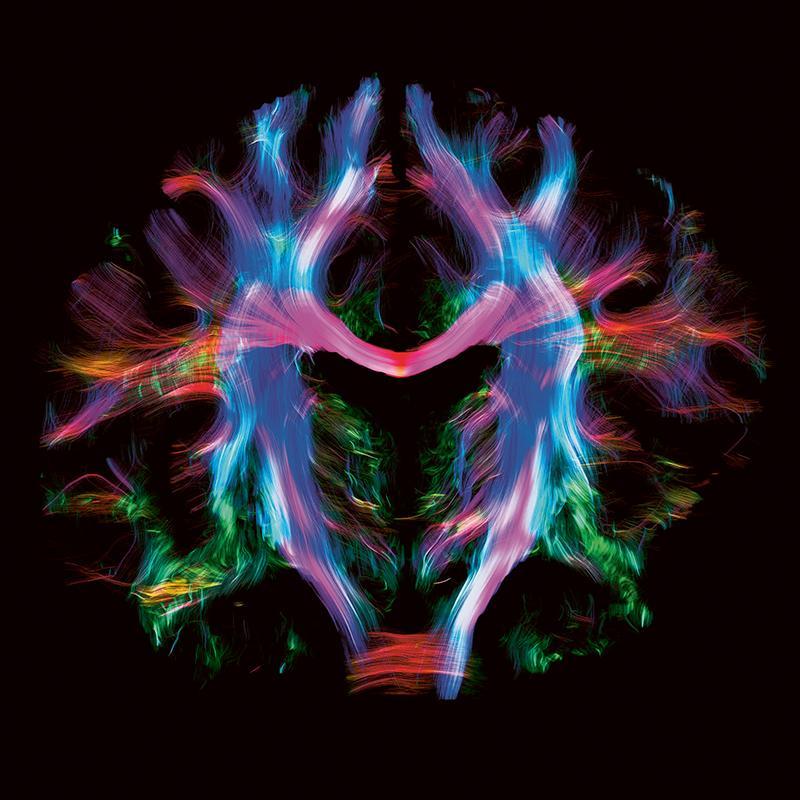 Grâce au fort signal de l'IRM 7T, il est possible de voir les fibres allant d’une région cérébrale à l’autre et se croisant dans certaines sub-régions cérébrales.