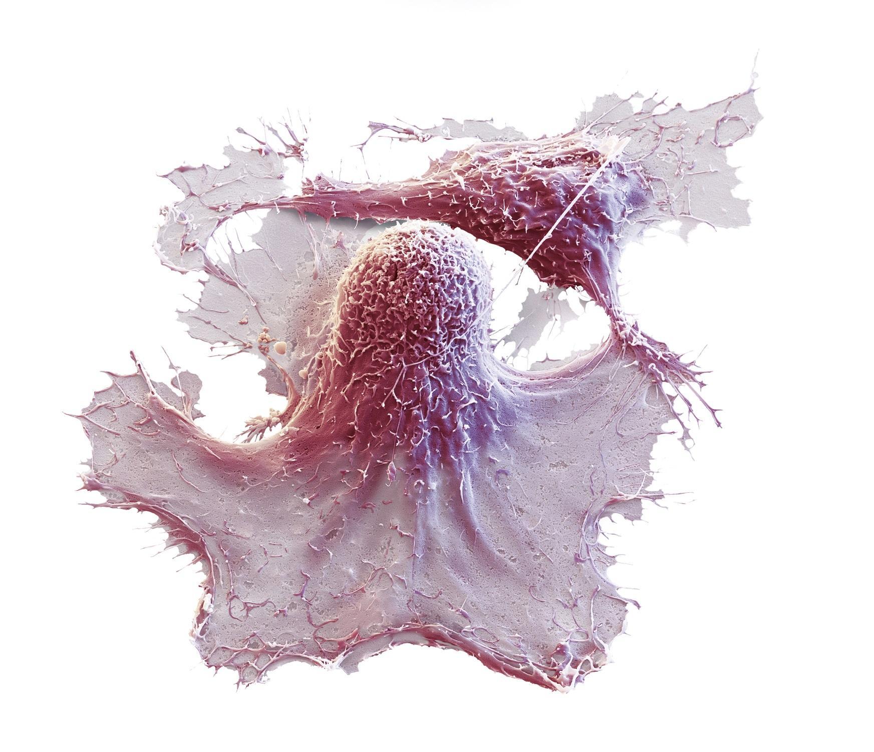 Cellule tueuse naturelle (NK) interagissant avec une cellule d’hépatome (HepG2), image grossie 10 000x.