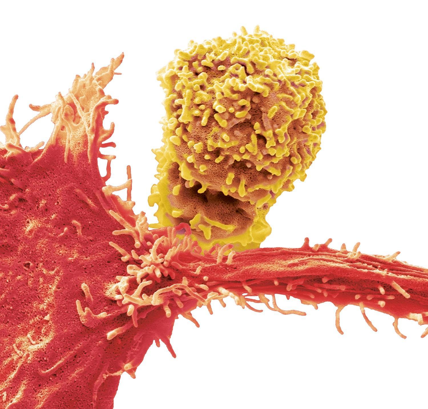 Cellule de cancer du sein avec des globules rouges du sang (image grossie 6000x). Cellule cancéreuse du foie en train de se diviser (image grossie 7600x). Cellule de cancer du sein avec des globules rouges du sang (image grossie 6000x). Cellule cancéreuse du foie en train de se diviser (image grossie 7600x).