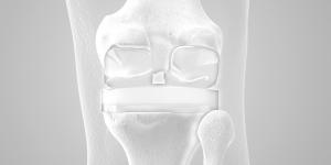 chirurgie orthopédique