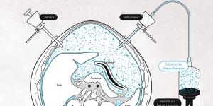 Schéma explicatif de la chimiothérapie par aérosol