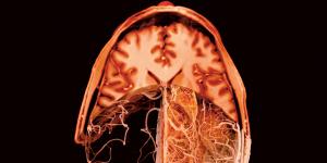 image montrant différents composants du cerveau