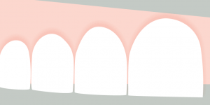 illustration dents