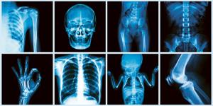 La fin du tablier en plomb en radiologie