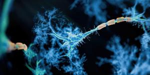 Espoir pour la sclérose en plaques